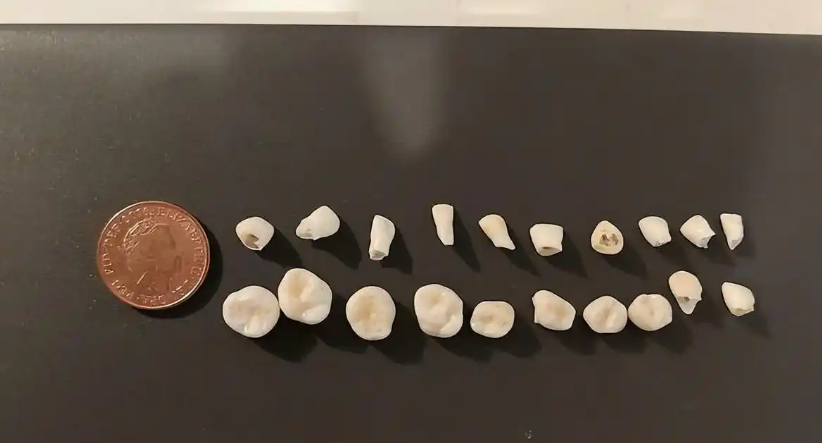 这些都是我掉的牙齿